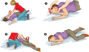 Spinal Recovery Position