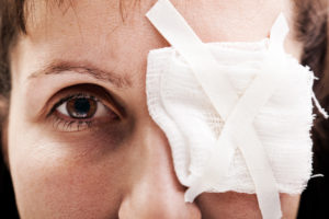 Eye Injuries